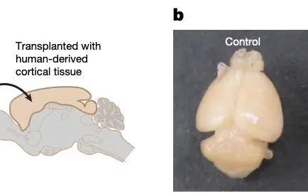 The Mouse With a Almost-Human Brain: Stanford's Chimera Breakthrough Rewrites Neuroscience