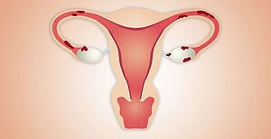 gettyimages-469121009-endometriosis-sognolucido-opener-1518557586_edited.jpg