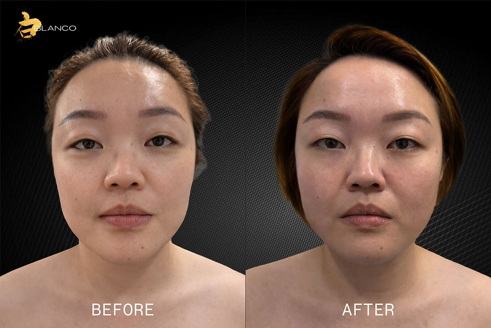 Model 3_Before and after_Model 3 - Phase 1.jpg