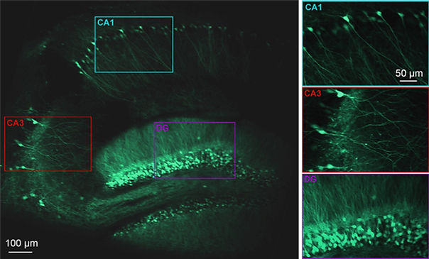 elife-75391-fig1-v1_edited.jpg