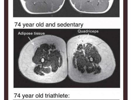 The Silent Crisis of Sarcopenia: Why "Being Active" Isn't Enough