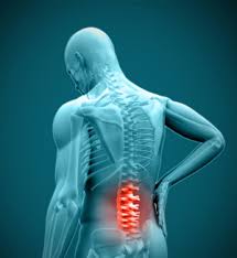 Prevent Back Pain during the holidays