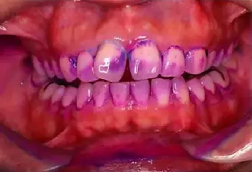f4672c50-c47f-41f8-afb0-89bb139b5a85.webp