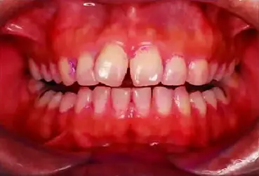 ebd2f526-d5b7-4d5c-8dda-7fbe4af2d167.webp