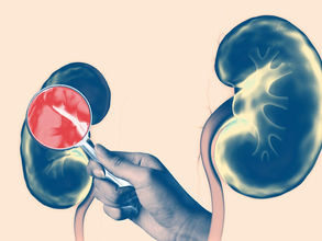 CKD-related Chronic Diseases