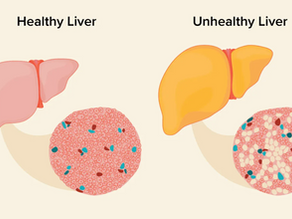 Liver Disease and Its Health Consequences