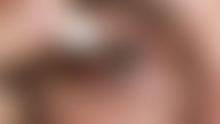 Olhos Vermelhos