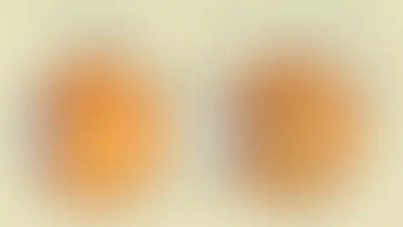 12 de março: Dia Mundial de Combate ao Glaucoma 