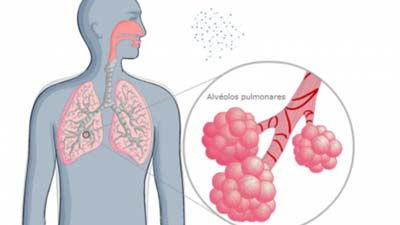 Recomendaciones y cuidados en el mes de la tuberculosis