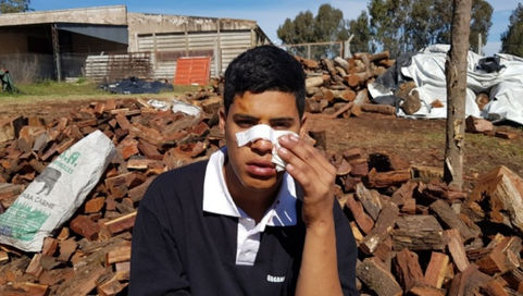 Un joven fue atacado por un perro en el rostro