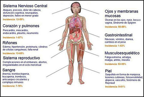 Medicación “es cara” y la cubre Salud Pública