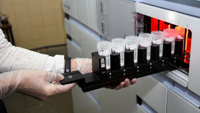 La Pampa incorporó biología molecular y elevó la seguridad de todas las donaciones de sangre