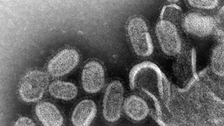 Detectan un caso importado de Gripe A en La Pampa: fue leve y no genera alarma sanitaria