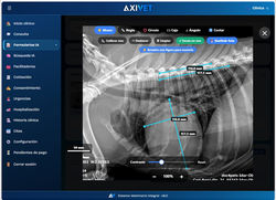 imagen radiografia