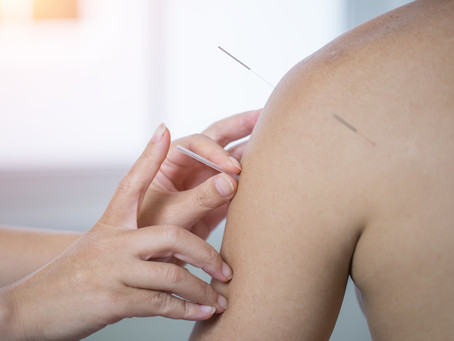 Science Says Acupuncture Works