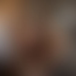 When Lightning Strikes