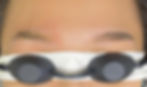 Pico Laser Tattoo Removal
