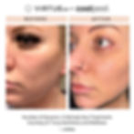 SkinLabULtimateDuo172770584040