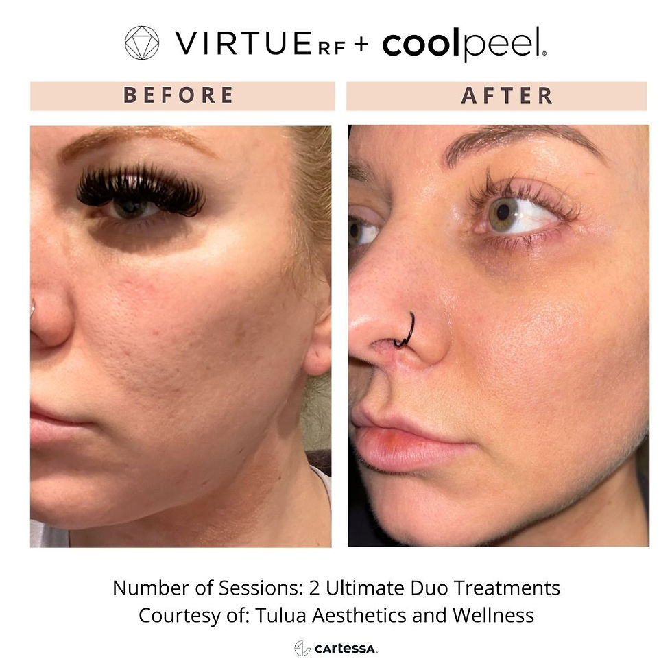 SkinLabULtimateDuo172770584040