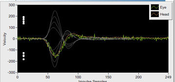 head-impulse-test-ics-impulse-tracing (1)