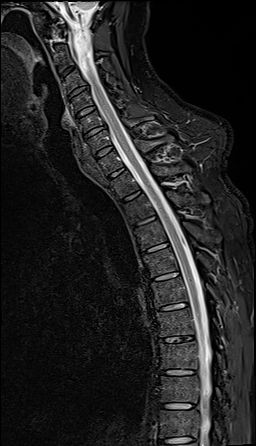 InkSpace Imaging high resolution sagittal images