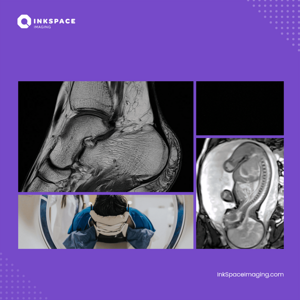 MRI Positioning Masterclass: Small Anatomy, Big Impact
