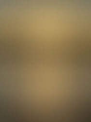 5 Strategies to Reduce Stress