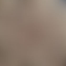 From Brewery Waste to Bio-based Circular Packaging