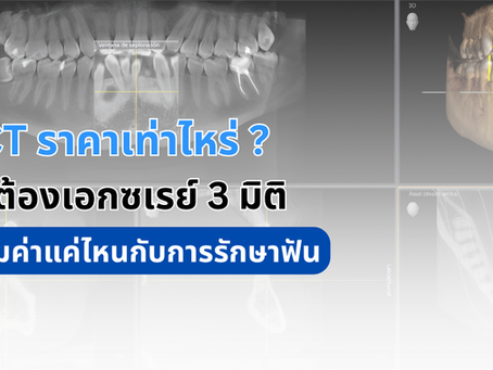 CBCT ราคาเท่าไหร่ ? ทำไมต้องเอกซเรย์ 3 มิติ และคุ้มค่าแค่ไหนกับการรักษาฟัน