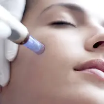 Microneedling