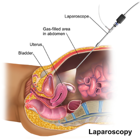 USB endoscopy camera, SDI endoscopy camera