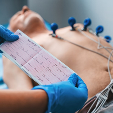 Electrocardiograma