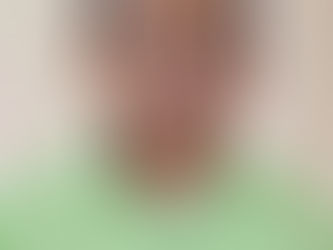 Concejal de Cajibío perdió un ojo tras brutal ataque en la vía Panamericana