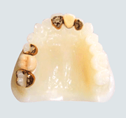 わかすぎ歯科クリニックヒューマンブリッジ