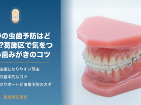 矯正中の虫歯予防はどうする?葛飾区で気をつけたい歯みがきのコツ