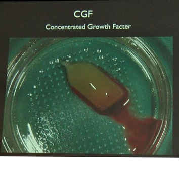 CGF