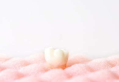 歯肉 歯根の健康相談 イメージ