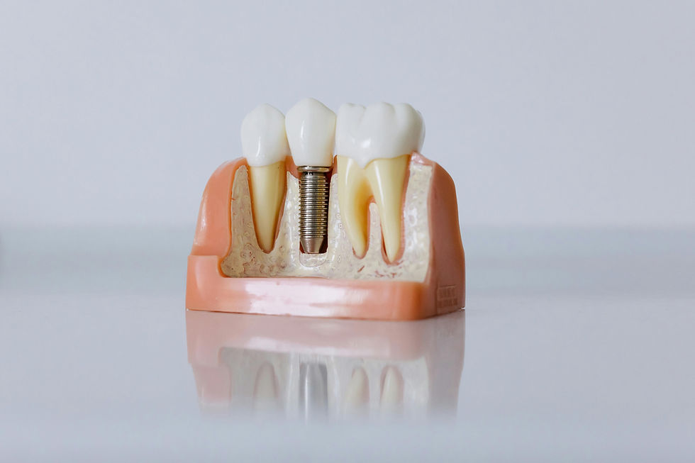 implante-dentario-em-joinville