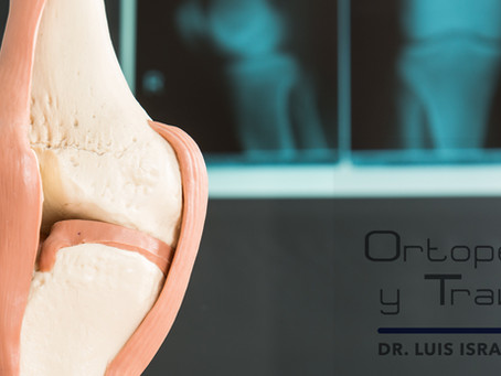 Causas de dolor de rodilla.
