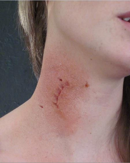 Prosaide Transfer Appliance