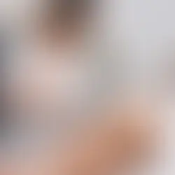 IPL vs Laser Hair Removal
