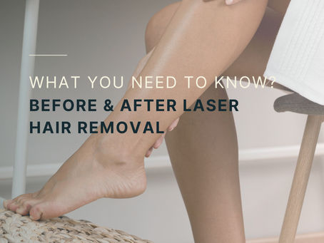 What you need to know? Before & After Laser Hair Removal
