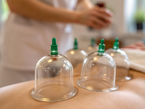 cupping therapy on back