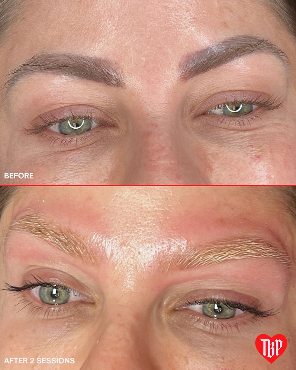 PICOSure Pro Dallas
PICOSure FAQ
laser tattoo removal Dallas
Brow Tone Dallas
skin rejuvenation Dallas
PICOSure tattoo removal
eyebrow tattoo removal Dallas
permanent makeup removal Dallas
PICOSure downtime
PICOSure aftercare
acne scar treatment Dallas
laser skin rejuvenation DFW
PICOSure Pro laser Dallas
tattoo removal consultation Dallas