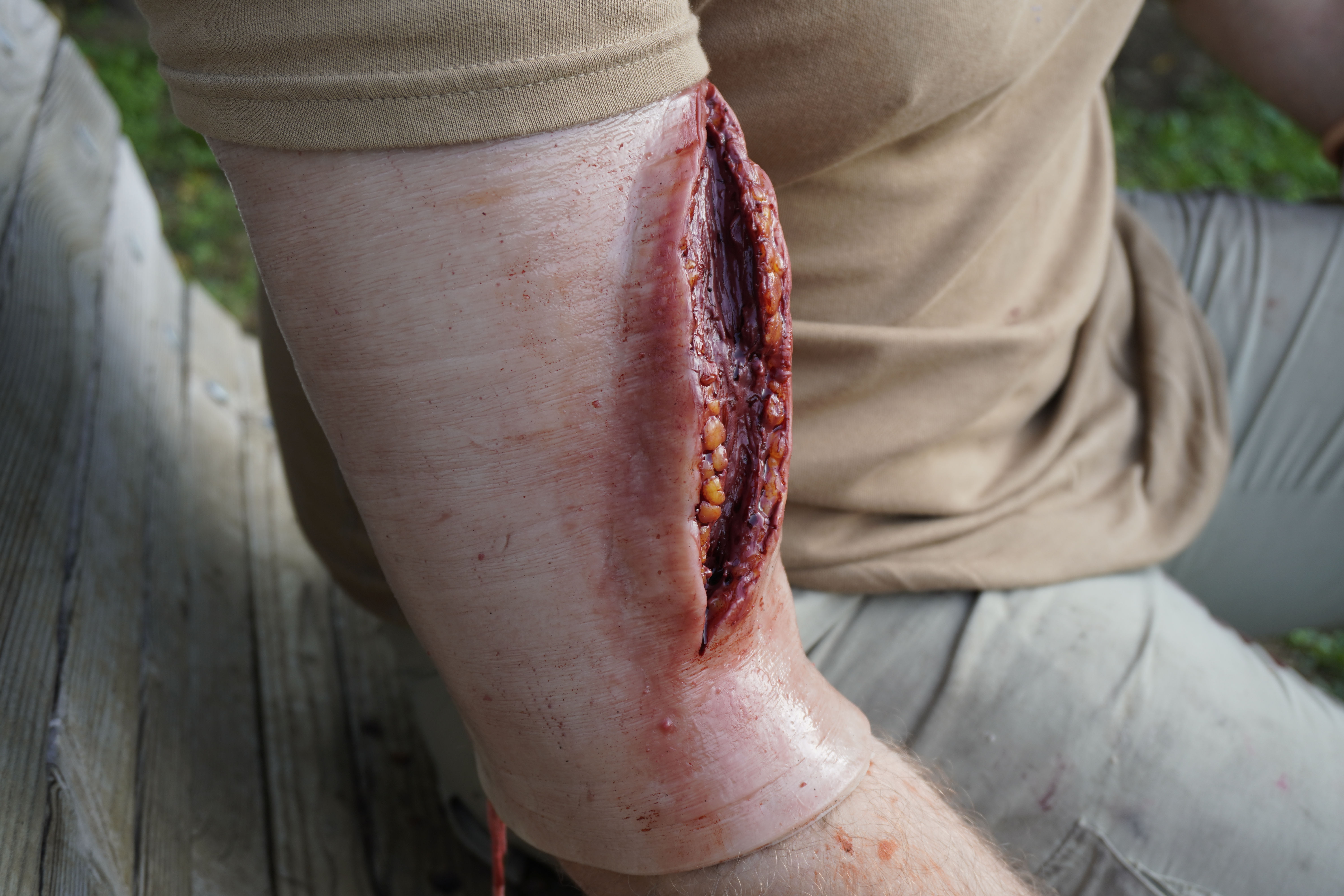 Attachable Laceration wound simulator with Bleeding set