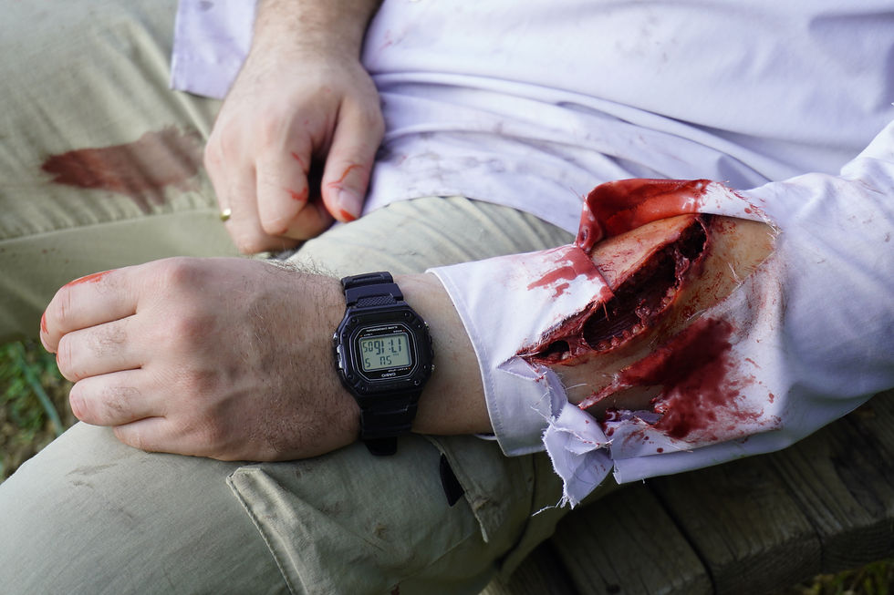 Thumbnail: Forearm/Lower leg Laceration