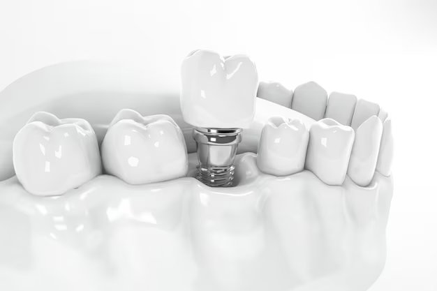 Dental Implants West Palm Beach