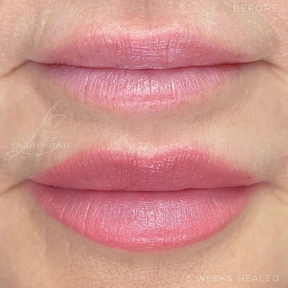 BEFORE & HEALED LIPS