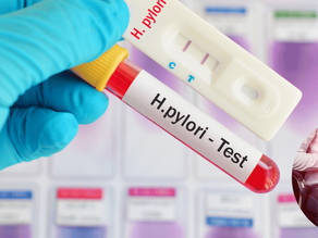 Los 6 sÃntomas más ocultos del helicobacter pylori