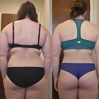 Woman's back before and after weight loss
